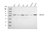 Anti-TROVE2/SS-A/RO60 Antibody Picoband® Boster Bio
