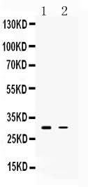 Anti-TSG6/TNFAIP6 Antibody Picoband® Boster Bio