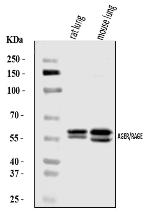 Anti-RAGE/AGER Antibody Picoband® Boster Bio