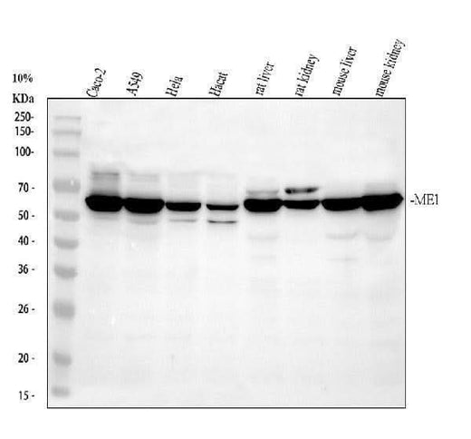 Anti-ME1 Antibody Picoband® Boster Bio