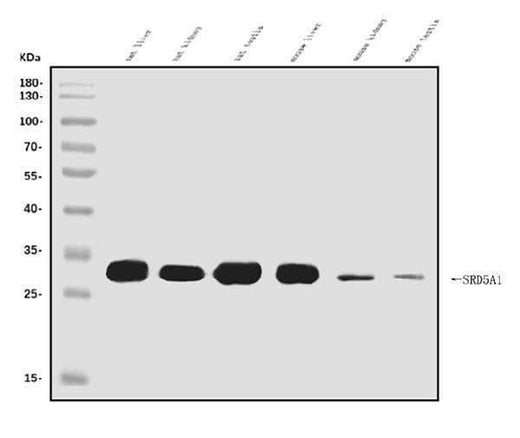 Anti-SRD5A1 Antibody Picoband® Boster Bio