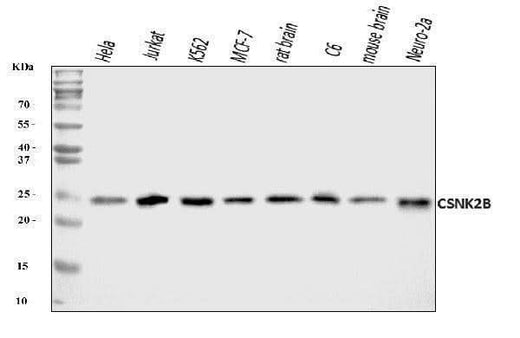 Anti-CSNK2B Antibody Picoband® Boster Bio