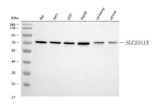 Anti-Citrin/SLC25A13 Antibody Picoband® Boster Bio