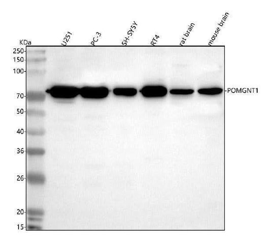 Anti-POMGNT1 Antibody Picoband® Boster Bio