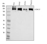Anti-CDK12 Antibody Picoband® Boster Bio