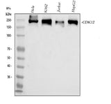 Anti-CDK12 Antibody Picoband® Boster Bio
