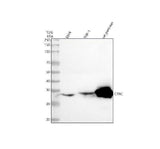 Anti-CTRC Antibody Picoband® Boster Bio