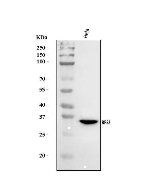 Anti-RPS2 Antibody Picoband® Boster Bio