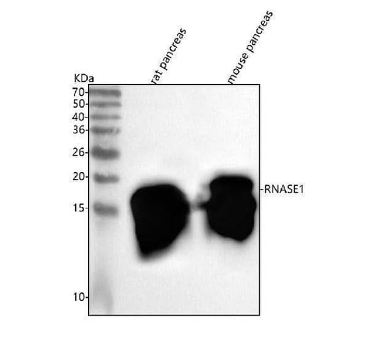 Anti-RNASE1 Antibody Picoband® Boster Bio