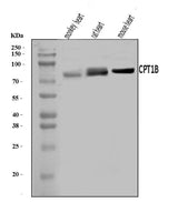 Anti-CPT1B Antibody Picoband® Boster Bio