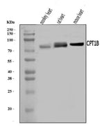 Anti-CPT1B Antibody Picoband® Boster Bio