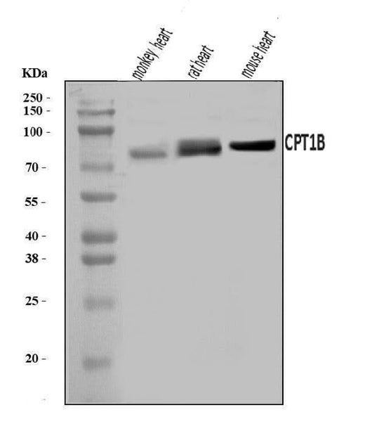 Anti-CPT1B Antibody Picoband® Boster Bio