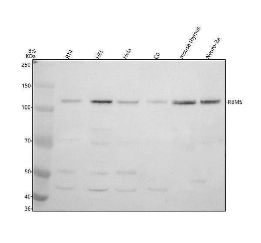 Anti-RBM5 Antibody Picoband® Boster Bio