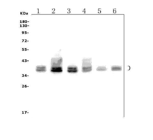 Anti-FOXF1 Picoband® Antibody Boster Bio