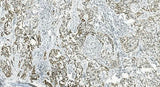 Anti-IL37 Antibody Boster Bio