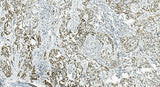 Anti-IL37 Antibody Boster Bio
