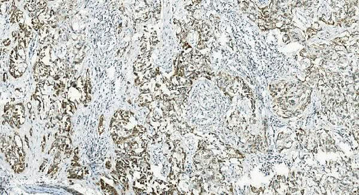 Anti-IL37 Antibody Boster Bio