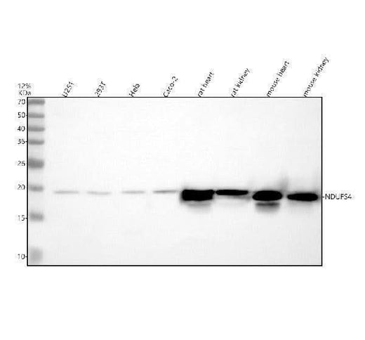 Anti-NDUFS4 Antibody Picoband® Boster Bio