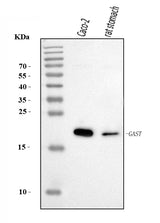 Anti-Gastrin/GAST Antibody Picoband® Boster Bio