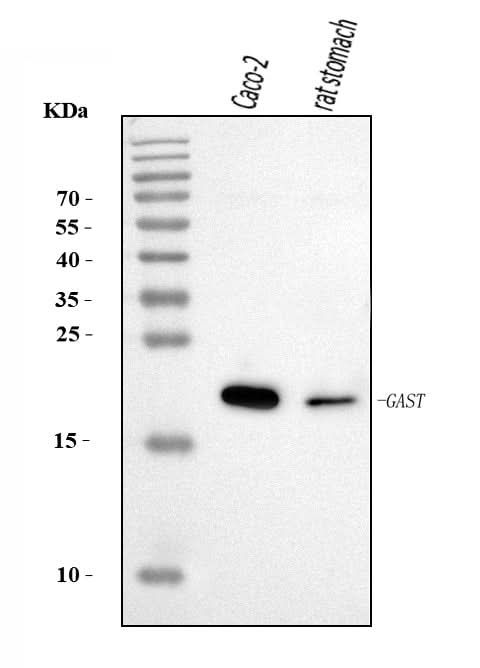 Anti-Gastrin/GAST Antibody Picoband® Boster Bio