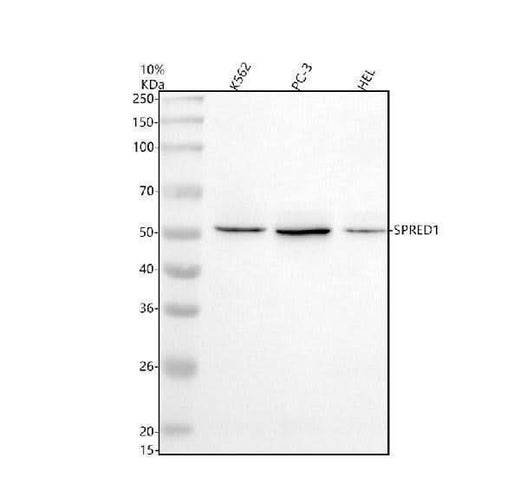 Anti-SPRED1 Antibody Picoband® Boster Bio