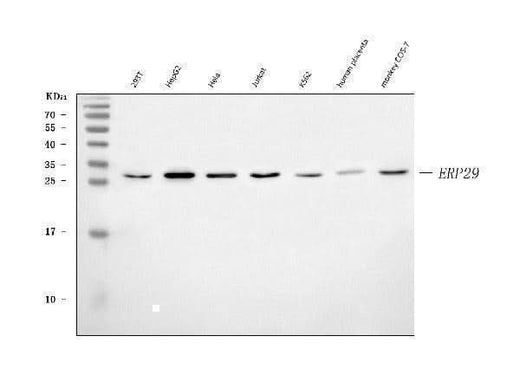Anti-ERP29 Antibody Picoband® Boster Bio