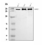 Anti-hUPF2/RENT2/UPF2 Antibody Picoband® Boster Bio