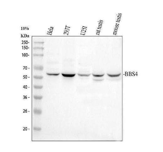 Anti-BBS4 Antibody Picoband® Boster Bio