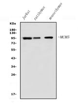 Anti-MCM5 Antibody Picoband® Boster Bio