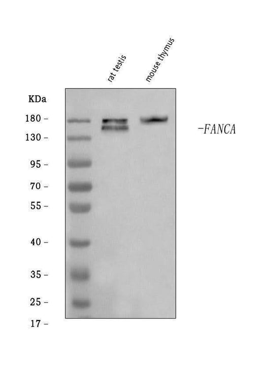 Anti-Fanca/FAA Antibody Picoband® Boster Bio