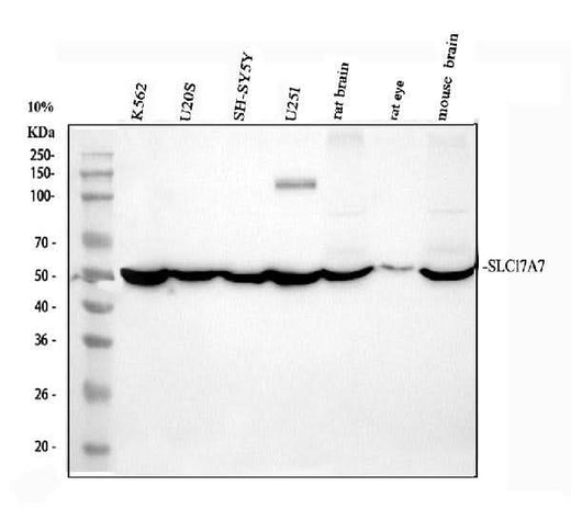 Anti-VGLUT1/SLC17A7 Antibody Picoband® Boster Bio