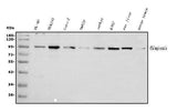 Anti-Plasminogen/PLG Antibody Picoband® Boster Bio