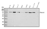 Anti-Plasminogen/PLG Antibody Picoband® Boster Bio