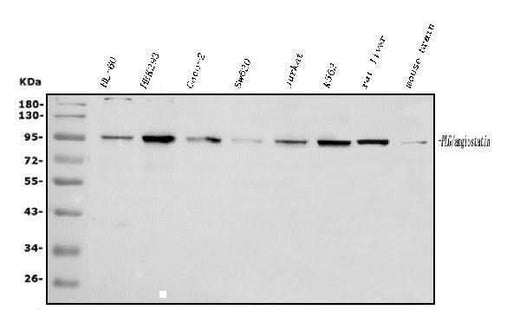 Anti-Plasminogen/PLG Antibody Picoband® Boster Bio