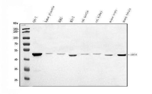 Anti-ORC5L/ORC5 Antibody Picoband® Boster Bio