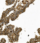 Anti-REN/Renin Antibody Boster Bio