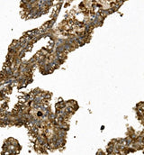 Anti-REN/Renin Antibody Boster Bio