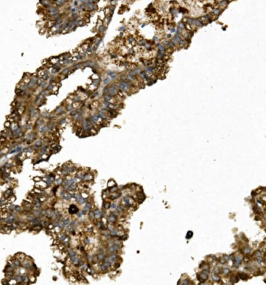 Anti-REN/Renin Antibody Boster Bio