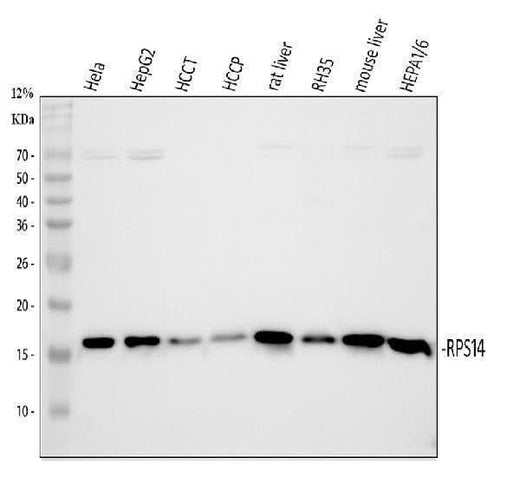 Anti-RPS14 Antibody Picoband® Boster Bio