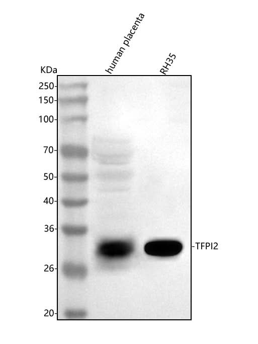 Anti-TFPI2 Antibody Picoband® Boster Bio