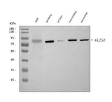 Anti-GLIS3 Antibody Picoband® Boster Bio