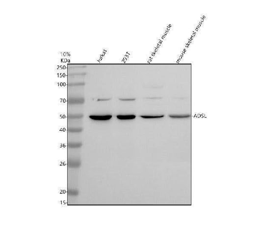 Anti-ADSL Antibody Picoband® Boster Bio