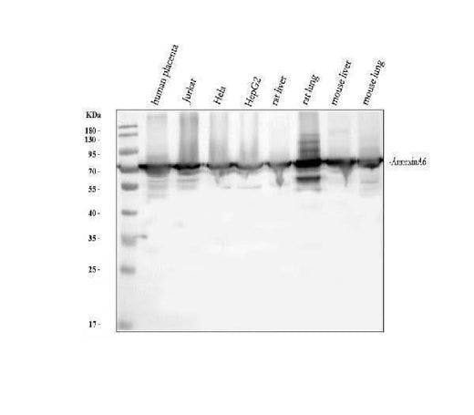 Anti-Annexin VI/ANXA6 Antibody Picoband® Boster Bio
