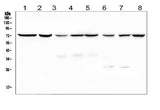 Anti-SGLT2/SLC5A2 Antibody Picoband® Boster Bio