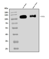 Anti-SV2A Antibody Picoband® Boster Bio
