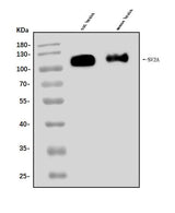 Anti-SV2A Antibody Picoband® Boster Bio