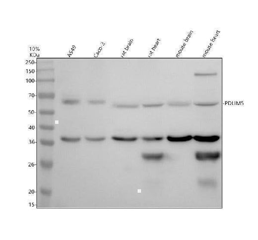 Anti-PDLIM5 Antibody Picoband® Boster Bio