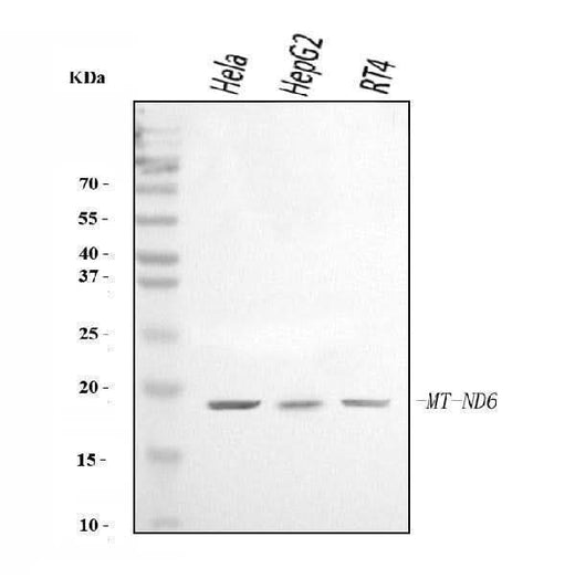Anti-ND6/MT-ND6 Antibody Picoband® Boster Bio