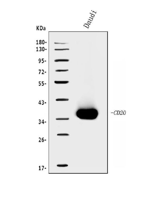 Anti-CD20/MS4A1 Antibody Picoband® Boster Bio