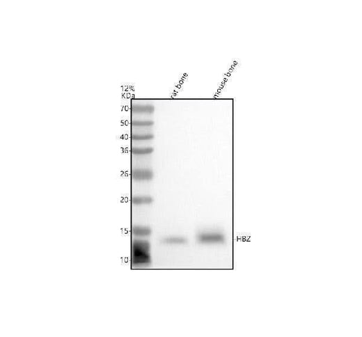 Anti-HBZ Antibody Picoband® Boster Bio